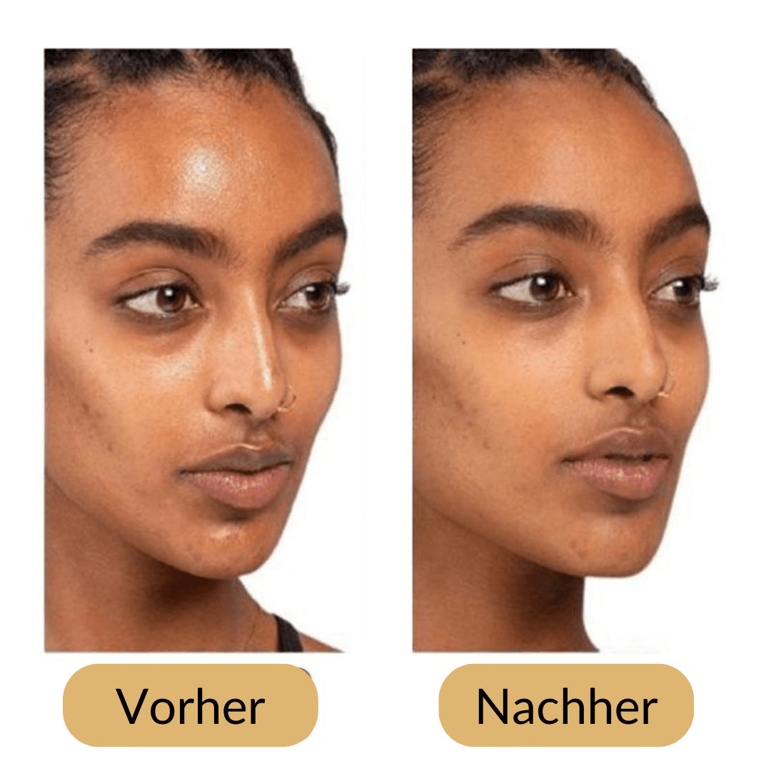 Lively® Cosmétiques & Soins Rouleau volcanique peau mate  | Lively®